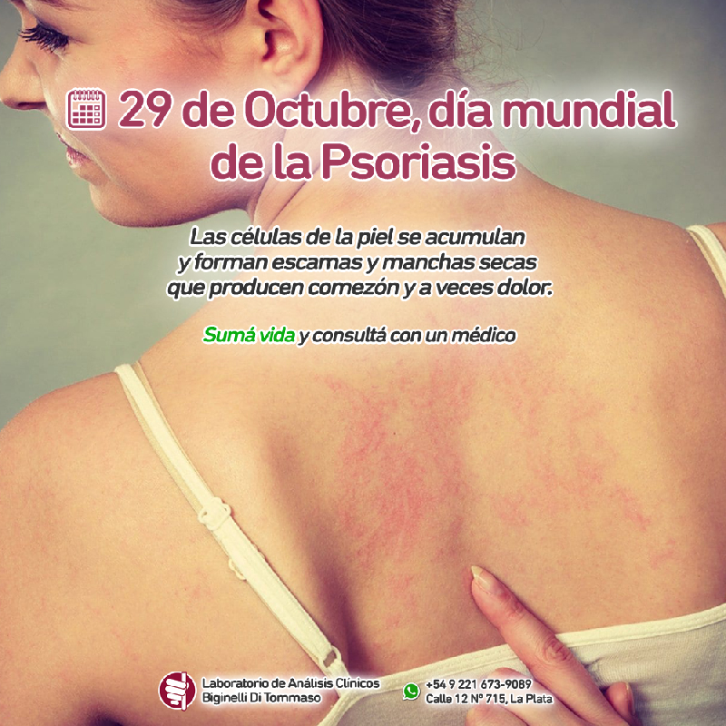 2019-10-28-Dia-mundial-de-la-psoriasis.jpg