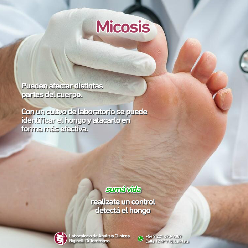 2019-12-16-micosis.jpg